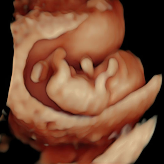 3d 4d Ultraschall Und Ultraschallbilder Ihres Babys Woman Health Frauenarzt Gynakologie 1010 Wien